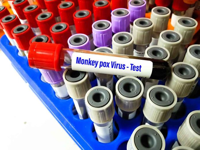 CDC Sounds the Alarm on Monkeypox Spread