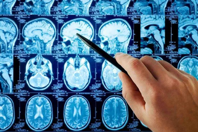 118491940 Hand pointing at brain scan images on screen.