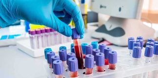 Cancer Codes Cracked Gloved hand holding a blood sample tube in a lab rack